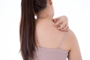 Akne am Rücken ist typischerweise während der Pubertät präsent, doch auch im Erwachsenenalter ist sie weit verbreitet. Neben dem Gesicht können auch am Rücken Anzeichen auftreten. Hier erfährst du, warum das passiert und wie du dagegen vorgehen kannst.